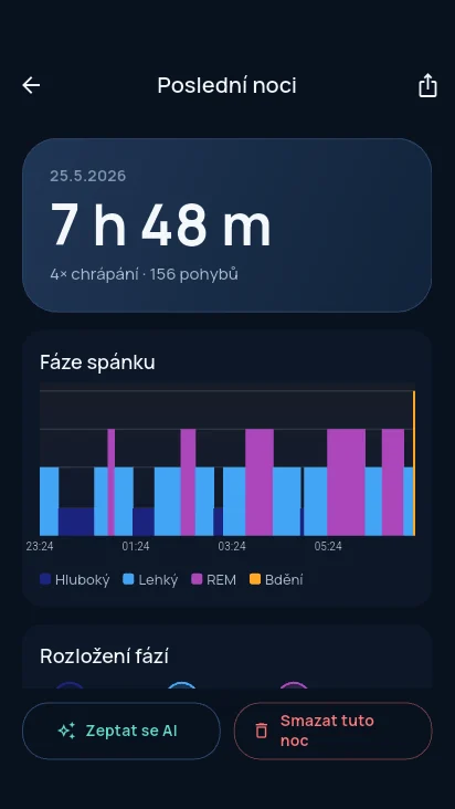 Morning summary in the Noxuma Sleep app: a hypnogram with sleep stages
